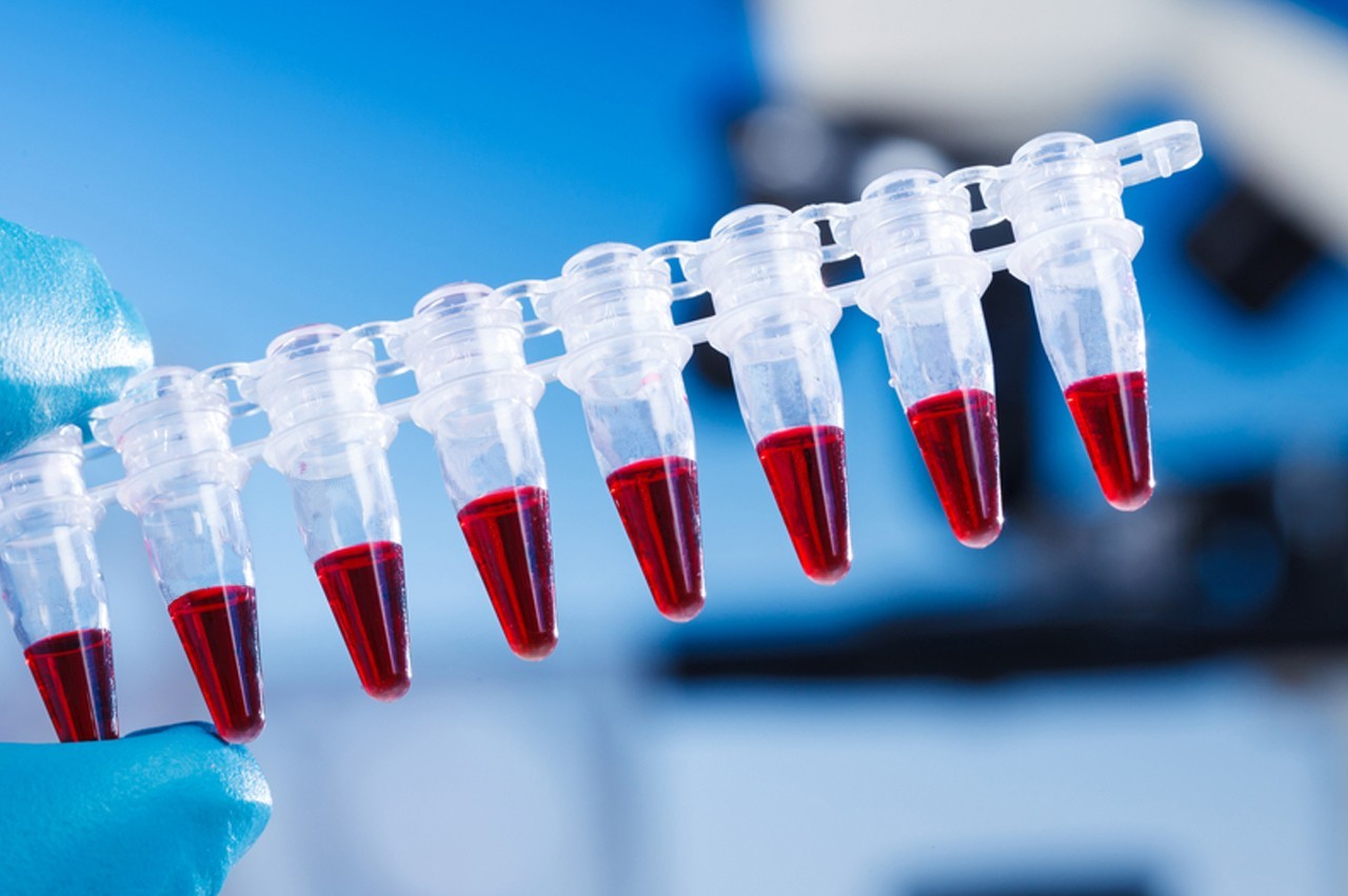 blood-test-could-help-detect-breast-cancer-cbs-news