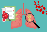 Lung Cancer in AI/AN populations