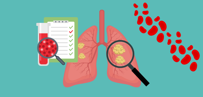 Lung Cancer in AI/AN populations